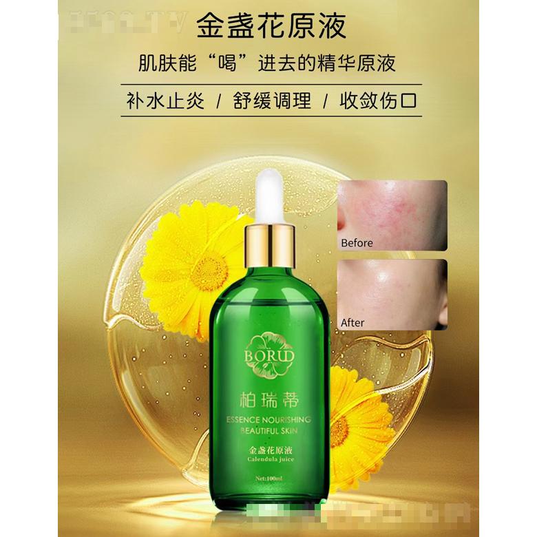 柏瑞蒂金盞花原液