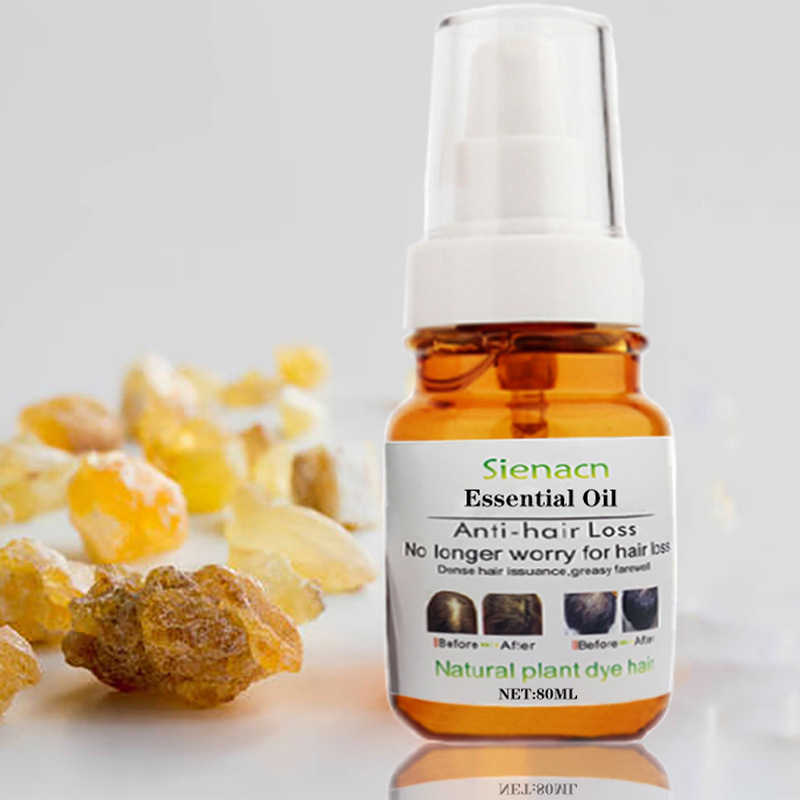 防脫護(hù)發(fā)精油改善毛躁干枯養(yǎng)發(fā)護(hù)發(fā)OEM代加工